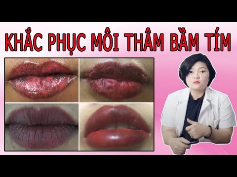 Cách Khắc Phục Môi Thâm Bầm Tím Đen Sau Phun Xăm Tại Nhà