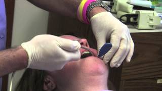 Marty Jablow  DMD - H and H Dental Impression Technique Demonstration Video