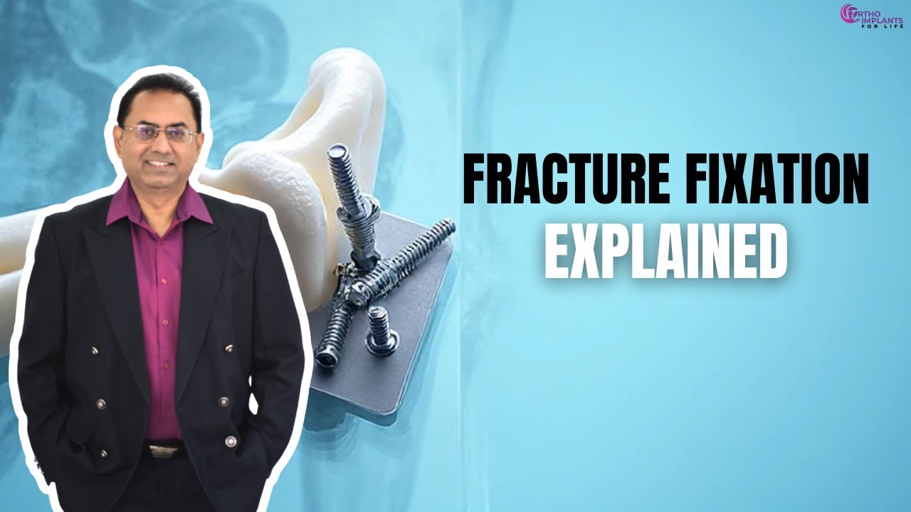 Fracture Fixation EXPLAINED: How Plates & Screws Actually Heal Bones!