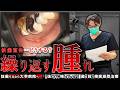 【抜歯宣告】繰り返す奥歯の腫れと膿 『抜かずに残す』歯を救う精密根管治療