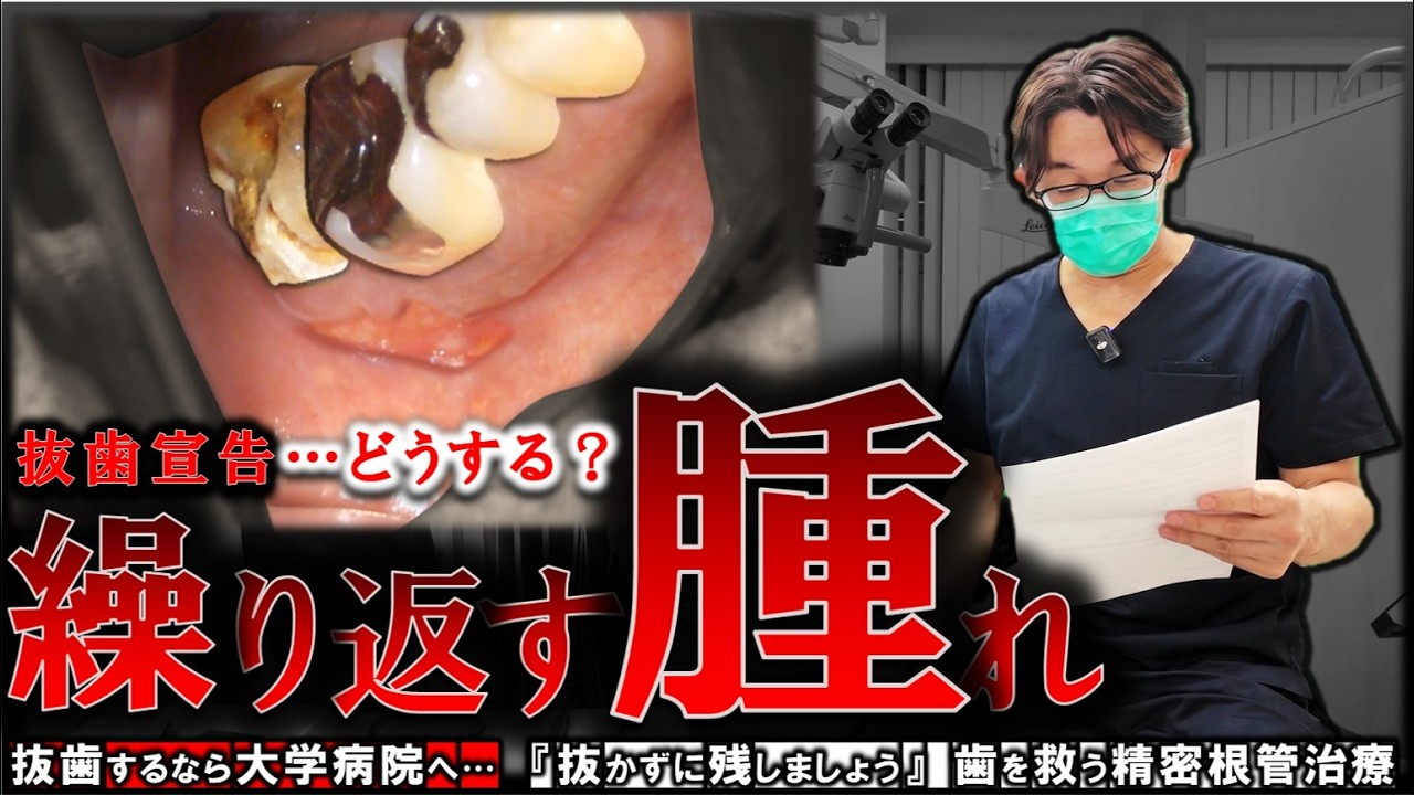 【抜歯宣告】繰り返す奥歯の腫れと膿 『抜かずに残す』歯を救う精密根管治療