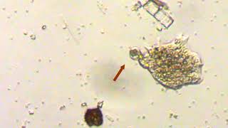 amoeba food vacuole discharge