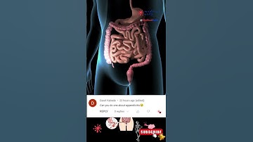 Appendicitis [] Appendix Location [] Appendicitis symptoms