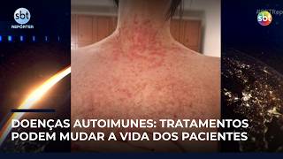 Pain, stigma, and years without answers: the challenges of autoimmune diseases | #SBTReporter