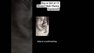 Laki-laki atau Perempuan pada Usia Kehamilan 12 Minggu? Penjelasan Teori Nub! #radiologi #TeoriNu...
