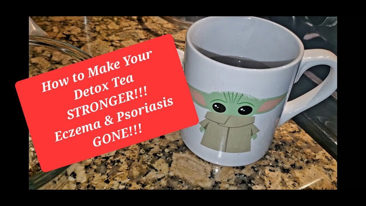 How to Make Your Detox Tea STRONGER!! Tips For Eczema & Psoriasis 