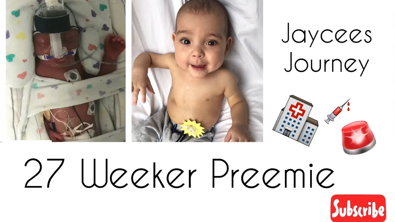 Preemie baby story | NICU to Now| 27 weeker Preemie story - YouTube