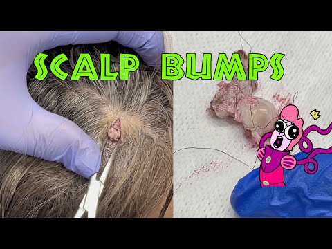 Javalina&rsquo;s Scalp Bumps - The Full Sacs Out - NEW VIDEO