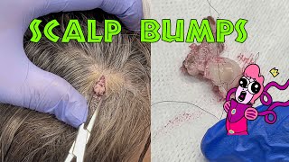 Javalina&#39;s Scalp Bumps - The Full Sacs Out - NEW VIDEO