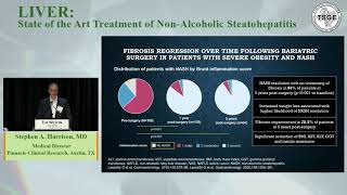 TSGE 2021 Annual Conference: Liver