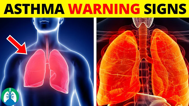 Top Early Warning Signs of Asthma That You Should NEVER IGNORE