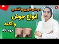 پوست شیشه ای و شفاف با این روش درمان انواع جوش صورت و بدن آکنه و لکه های پوستی