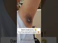 🔥Best Home Remedies For Dark Underarms 🤧 #shorts #skincare Smbeautylandstudio