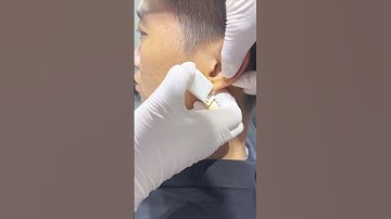 Bấm lỗ tai an toàn được thực hiện nhanh chóng tại TinyBox