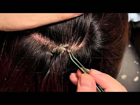 3 Hours ｜ JOJO ASMR Scalp Care — Gentle Tweezer Accents & Steady Comb Rhythm | No Talking