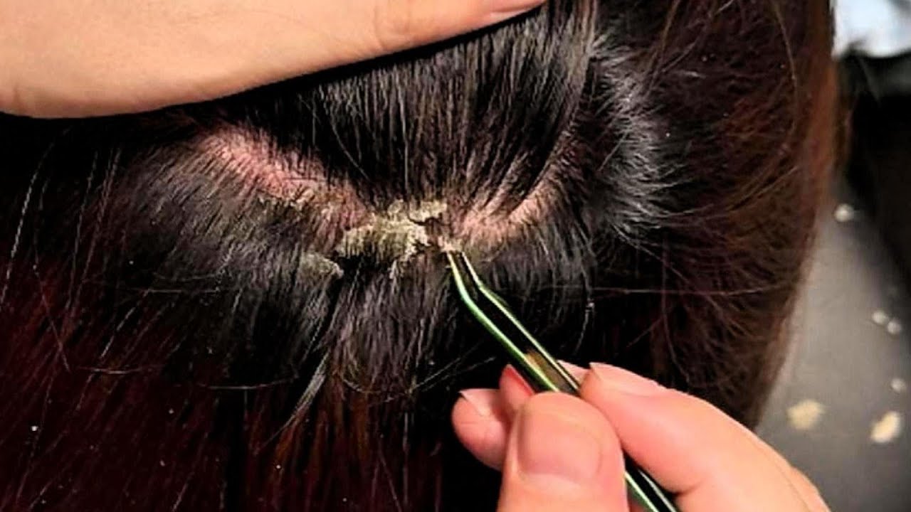 3 Hours ｜ JOJO ASMR Scalp Care — Gentle Tweezer Accents & Steady Comb Rhythm | No Talking