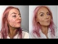 LETS TALK ACNE | ACCUTANE | GET READY WITH ME | ABBIE BULL