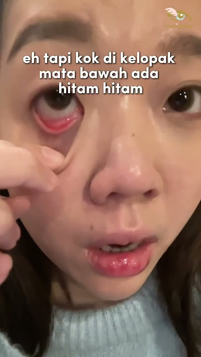 Ternyata ini nih salah satu penyebab mata perih sakit pas pake softlens! #YourKawaiLens #softlens