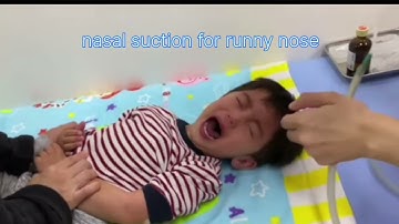 nasal suction for runny nose