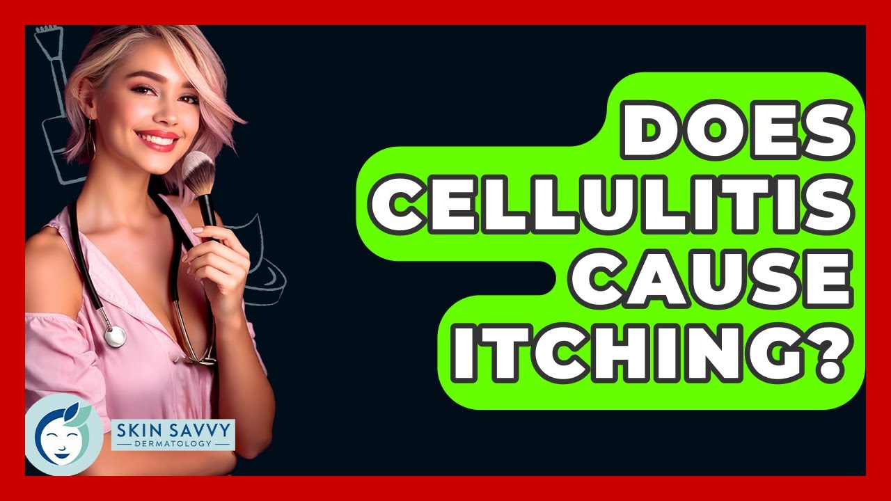 Does Cellulitis Cause Itching? - Skin Savvy Dermatology