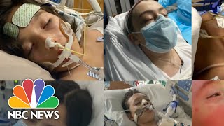 Cdc Alerts Doctors On Mystery Child Inflammatory Illness Symptoms Nbc Nightly News