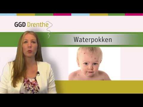 Video: Tsindol Voor Waterpokken Bij Kinderen: Instructies Voor Gebruik