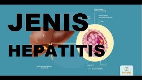 Perbedaan Hepatitis A B dan C kalian harus Tau