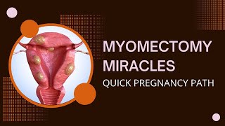 How to Get Pregnant Fast After Myomectomy | Useful Tips & Tricks