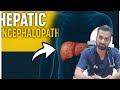 Hepatic Encephalopathy Explained | Symptoms, Causes & Treatment | Liver Failure Warning Signs