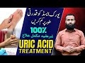 Uric acid treatment  natural remedies for gout get rid of hyperuricemia