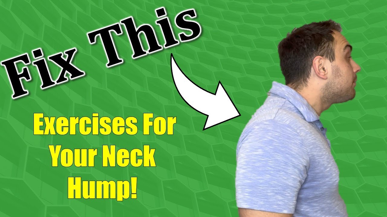 How to Fix Your Neck Hump! YouTube