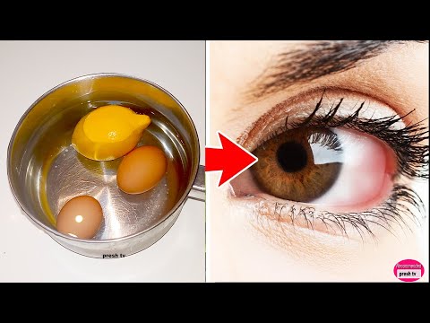 Say goodbye to eyeglass get clearer and stronger vision fast / Get White Eyes Naturally with egg
