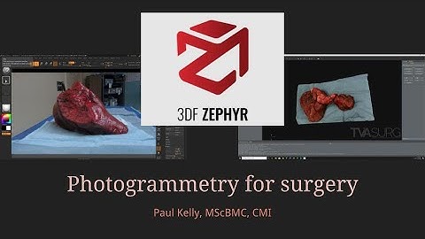 AMI 2021 Tech Talk - Photogrammetry for surgery with 3DFlow Zephyr