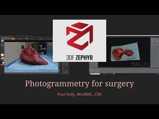 AMI 2021 Tech Talk - Photogrammetry for surgery with 3DFlow Zephyr