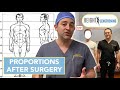 Will My Body Be Proportional After Limb Lengthening Surgery? | Height Lengthening FAQs