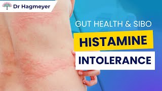 Histamine Intolerance, Gut Health and SIBO- How The Gut Is tied into Histamine Intolerance