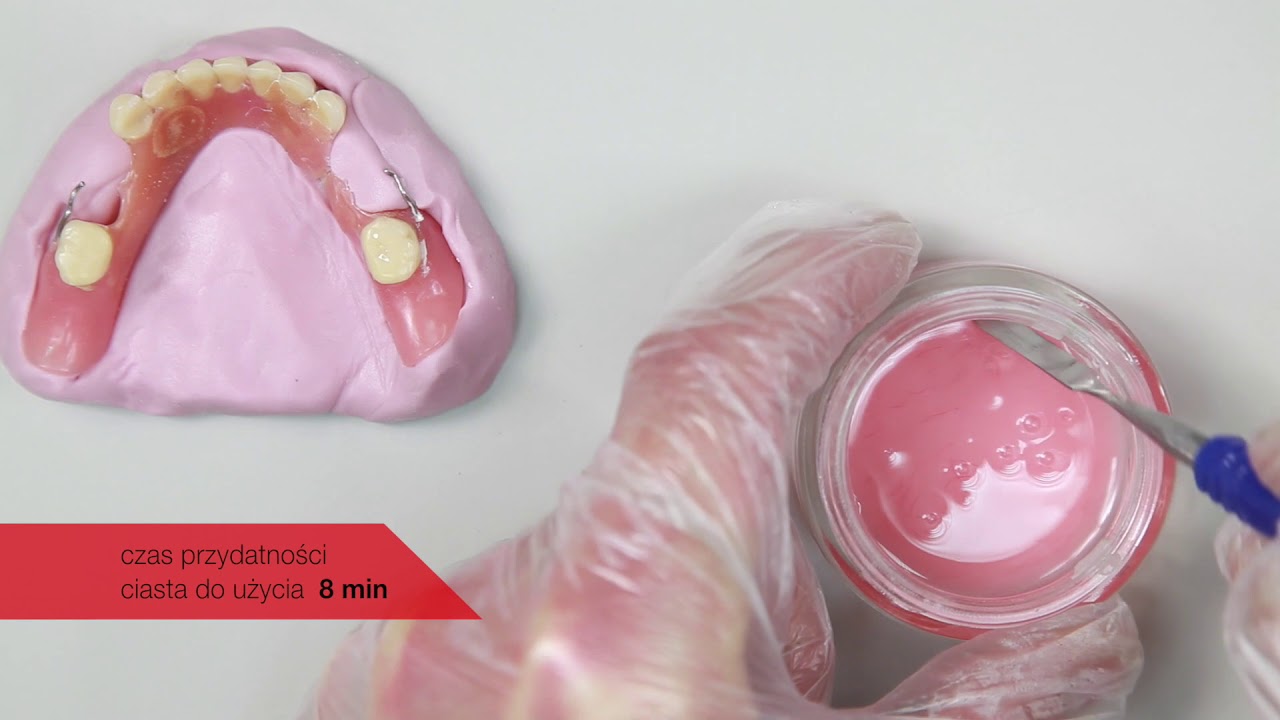 Трещина в протезе. Починка съемного протеза. Починка пластиночного протеза. Приварка зуба к съемному протезу. Починка и перебазировка протезов.