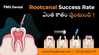 Root Canal Success Rate ఎంత శాతం వుంటుంది ? | Re RCT అంటే ఏమిటి ? | FMS Dental