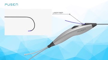 Video Single Use Ureteroscope from Pusen