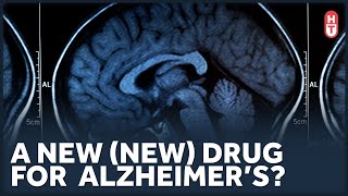 Some Good News in Alzheimer&#39;s Treatments