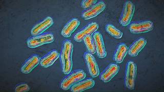 Health s share cyclosporiasis guidance in Maine