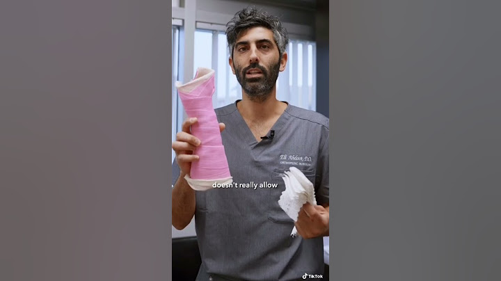 CAST vs SPLINT? Why is one used vs the other in orthopedics? #education #Nurses #injury #SignMyCast