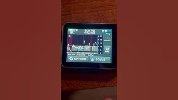 A good Tandem insulin pump with the unreliable Dexcom G7 a very poor quality CGM