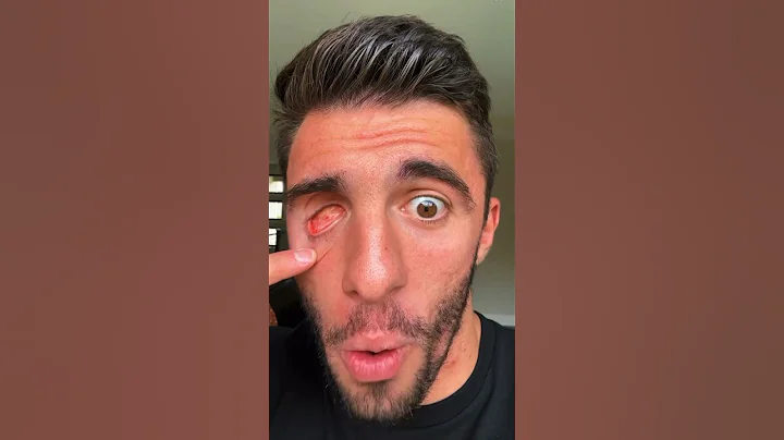 WHAT I SEE WITH NO EYEBALL 😳