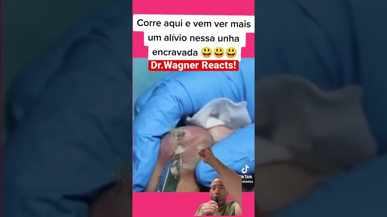 INGROWN TOENAIL BREAKS THROUGH THE SKIN Shorts