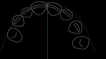 Magic move using DSD Keynote