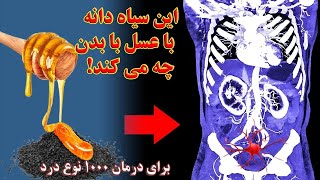 خواص سیاه دانه با عسل