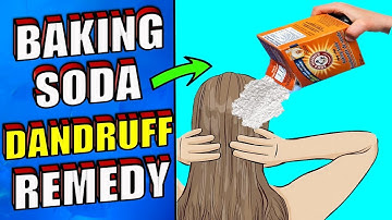 How To Get Rid of Dandruff With Baking Soda