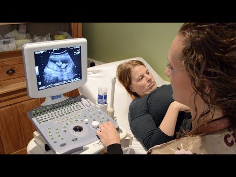 ZwangerMijlpalen | Hoe gaat een echo in zijn werk? | Verloskundige vertelt en voert termijnecho uit