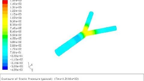 FSI simulation of bifurcation